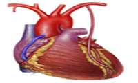 آنژیوپلاستی عروق کرونر از طریق شریان رادیال