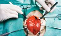 بخش جراحی قلب مجتمع بیمارستانی شهید دکتر بهشتی کاشان 3 ساله شد .         