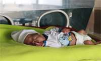 به دنیا آمدن نوزاد با وزن 420گرم در مجتمع بیمارستانی شهید دکتر بهشتی  